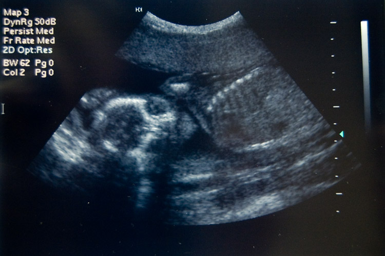 Hello, baby boy